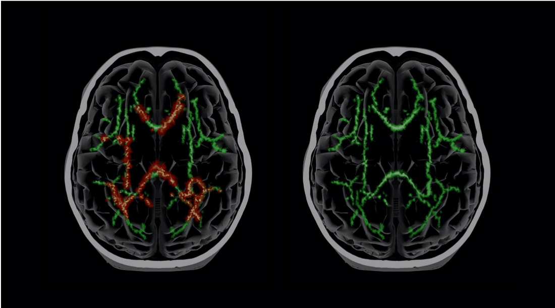 Expanding Our Understanding of Brain Injuries - Q30